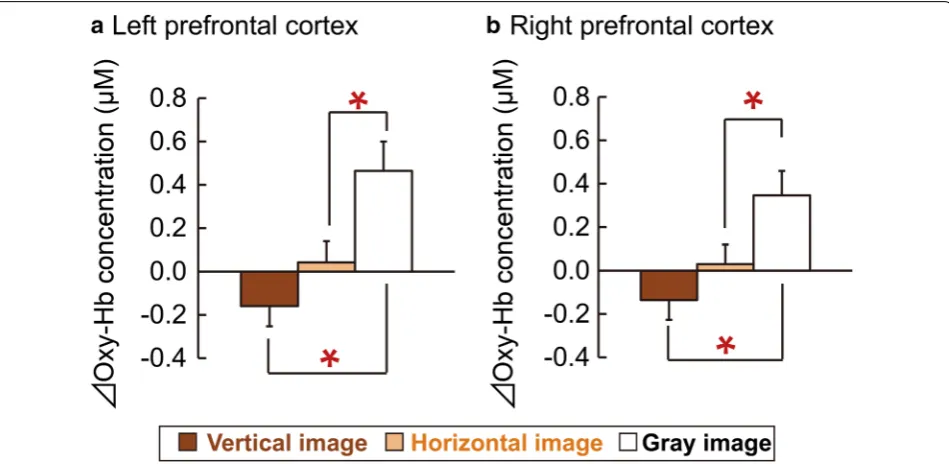 Fig. 6 Overall mean oxyhemoglobin (oxy-Hb) concentrations in the left and right prefrontal cortex