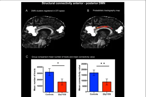 Fig. 2 Structural connectivity between the anterior and the posterior node of the DMN (default mode network)