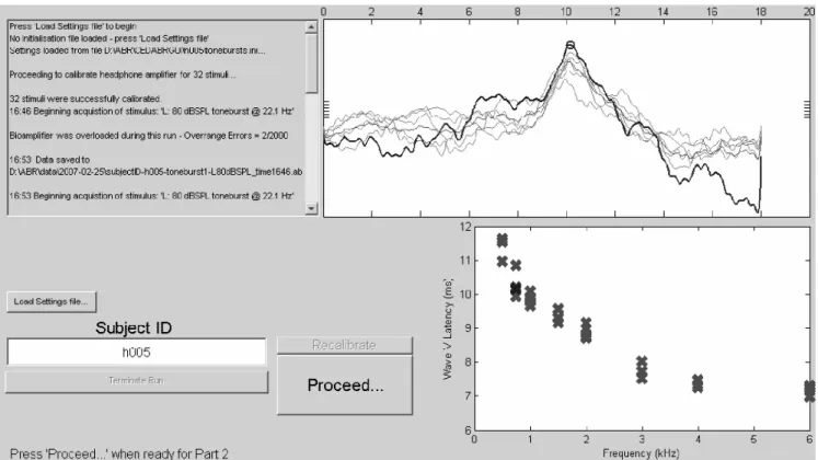 Fig. 3. The interface used for our ABR acquisitions. At the bottom right is the summary chart of marked Wave V locations versus toneburst frequency.