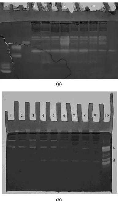 Figure 5. mice blood plasma with MAb directed against plasminogen: 1) plasmin standard (MW 82 kDa); 2) miniplasmin standard (MW 36 kDa); Western-blot of Lewis carcinoma 3) blood plasma sample