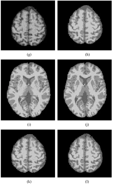 Figure 2. Segmentation results under different noise levels compared (a), (e) and (i) contain 3%, respectively, 5% and 7% of the noise of the image