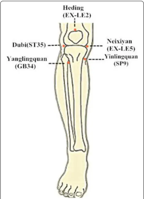 Fig. 2 Location of acupoints. Five points are used for each patient.They are Dubi (ST35), Neixiyan (EX-LE5), Heding (EX-LE2), Yinlingquan (SP9),and Yanglingquan (GB 34)