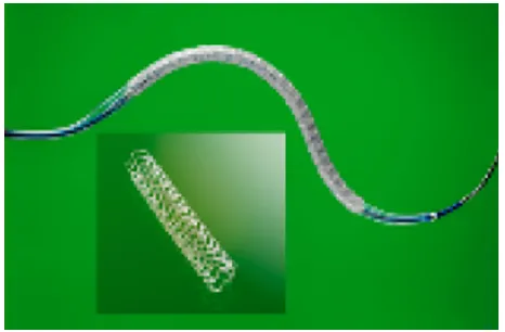 Table 2 Bioabsorbable stents: examples