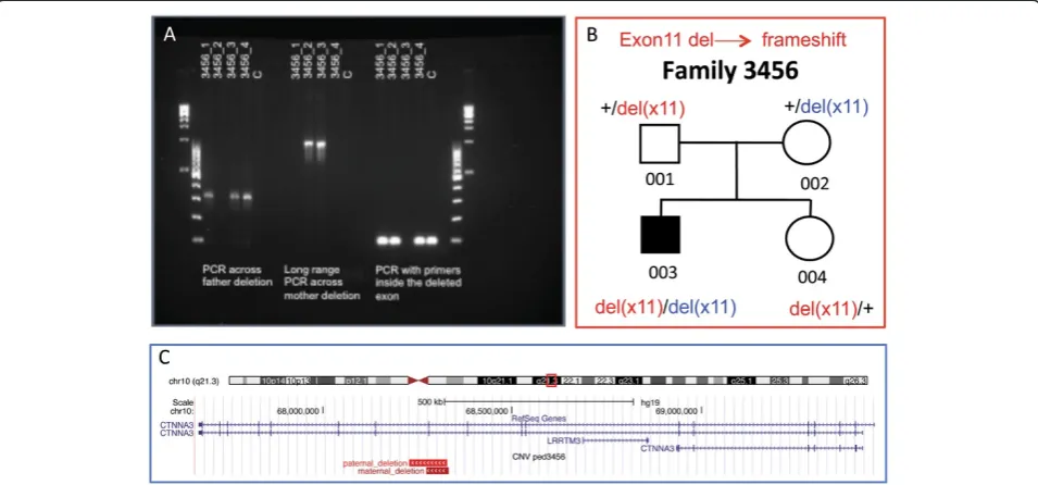 Figure 2 Further characterisation ofdeletion breakpoints, respectively: only the allele with the deletion can be amplified and visualized as a band of 301 bp in the father, in the probandand the unaffected sister, and as a band of 949 bp in the mother and 