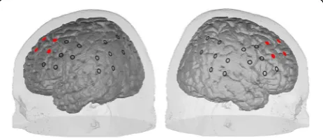 Fig. 3 Alignment of the NIRS channels on the cortex surface. Theeight channels from which the feedback signal is computed aremarked in red