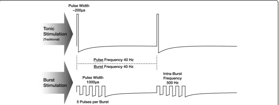 Fig. 3 Waveforms. Tonic stimulation provides a consistent stream of pulses at a set frequency, pulse width, and amplitude