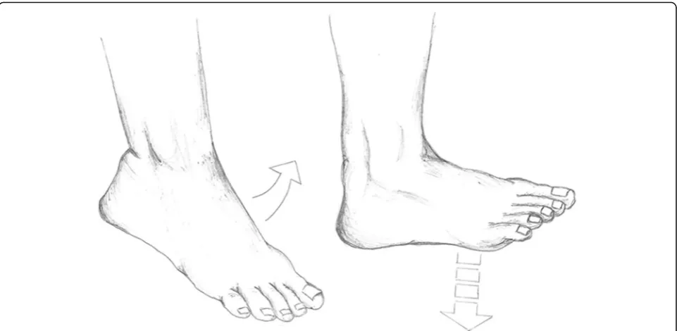 Fig. 2 The intervention: early controlled motion of the ankle joint. The orthosis is removed with the patient sitting on the edge of a table withboth legs hanging