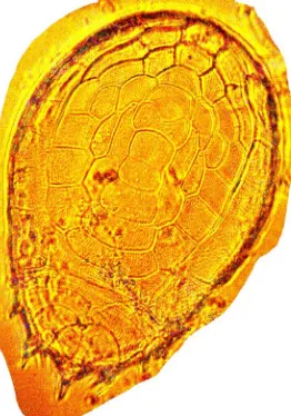 Figure 10. Microphotograph of Type XII—Hansenocaris portblairenae sp. (nov). Dorsal View