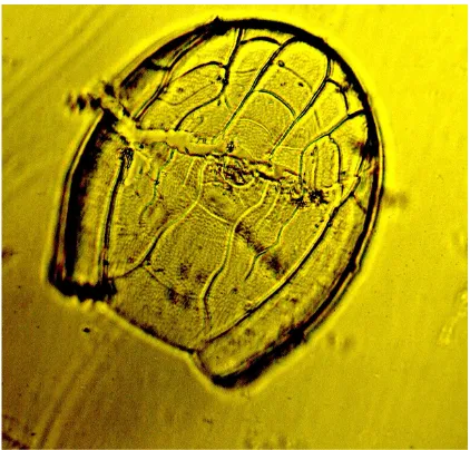 Figure 3. Microphotograph of type I—Hansenocaris cor-vinae species dorsal view (partially damaged during the photograph)