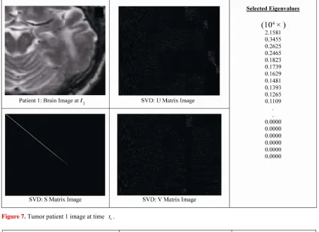 Figure 7. Tumor patient 1 image at time t1 . 