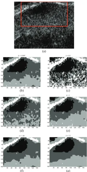 Fig. 5. (a) Multilook SAR image. (b) Optical image corresponding to (a), MAP labels when (c) β is estimated and (d) for β = 1.