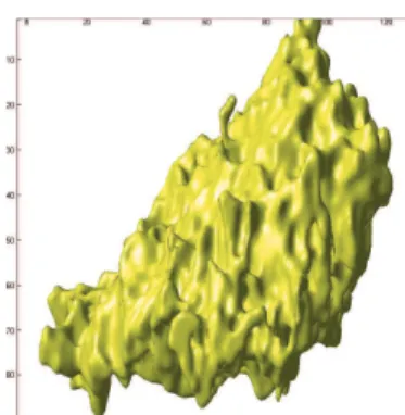 Fig. 7. Frontal viewpoint of a 3D reconstruction of the skin lesion.