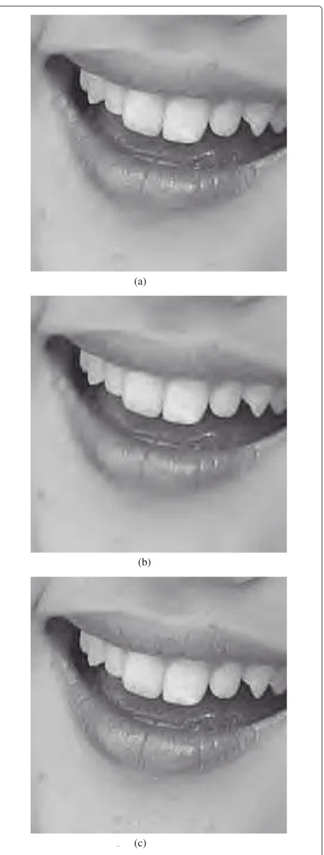 Figure 4 Subjective comparison of the Woman image encodedat 0.25 bpp. (a) SPIHT (PSNR = 29.95 dB)