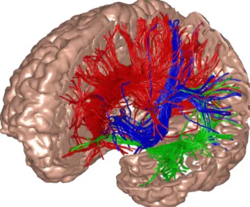 Fig. 1. The model’s global thalamocortical geometry and white matter anatomy was obtained by means of diffusion tensor imaging (DTI) of a normal human brain
