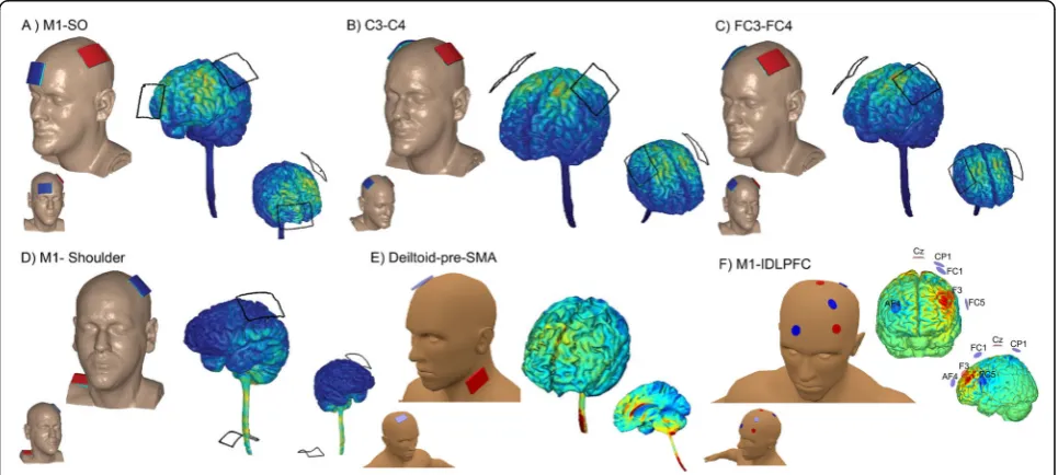 Fig. 4 Examples of electrode montage. a Spinal Cord Injury [137]: 5x7 cm; 2 mA; 20 min; 10 sessions; the anodal electrode placed overC3/C4 contralateral to the targeted arm and the cathodal electrode located over contralateral supraorbital area