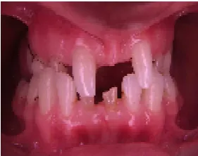 Fig 6: abnormality in teeth 