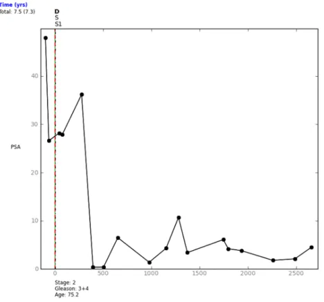 Fig. 5. A Pathway plot for a patient diagnosed with Gleason grade 7 prostate cancer who underwent a radical prostatectomy (code S).