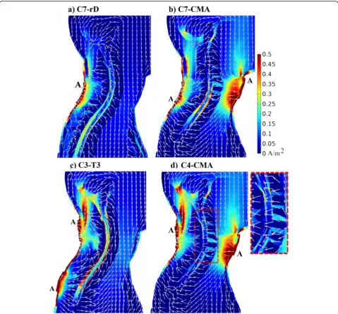 Fig. 2 Current density magnitude distribution in a sagittal slice of the upper thoracic and neck regions for each electrode montage, with thecurrent direction represented by grey arrows of the same length: a) C7-rD, b) C7-CMA; c) C3-T3; d) C4-CMA