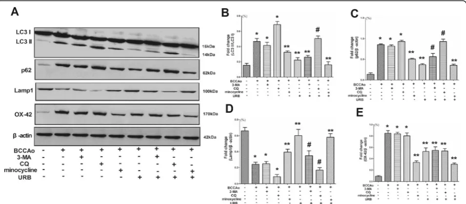 Fig. 7 Effects of URB autophagy inhibitor 3-MA and lysosome inhibitor CQ on CCH-induced alterations of mitochondrial ultrastructure.Representative electron micrographs of mitochondria in neurons (scale bars = 2 μm)