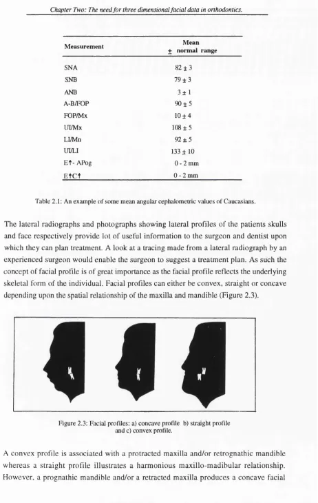 Table 2.1: An example of some mean angular cephalometric values of Caucasians.