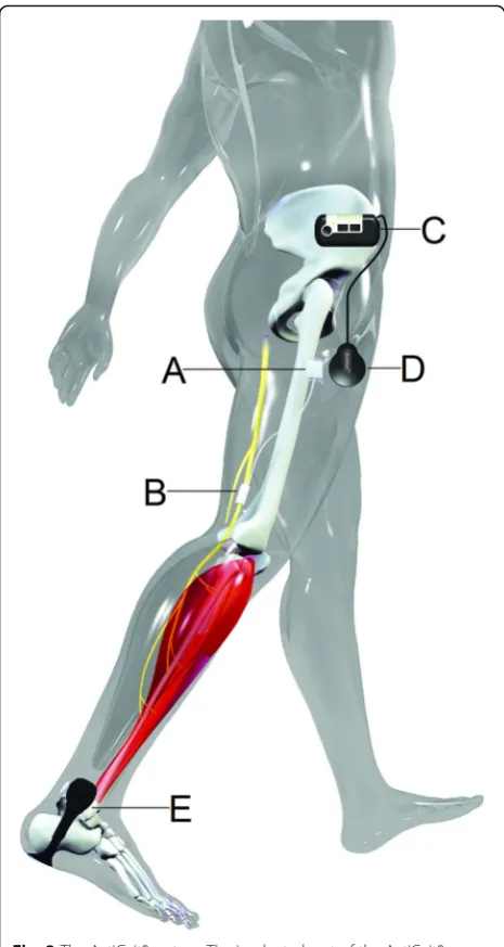 Fig. 2 The ActiGait® system. The implanted part of the ActiGait®heel switch (placed around the common peroneal nerve
