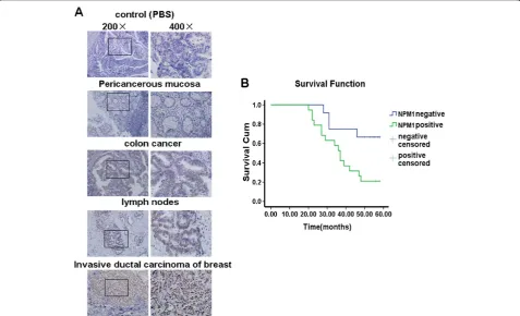 Figure 1 Increased NPM1 expression was associated with lymph node metastasis and poor survival rate of colon cancer patients