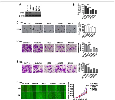 Figure 2 Expression of NPM1 was elevated in highly invasive colon cancer cell line HCT116