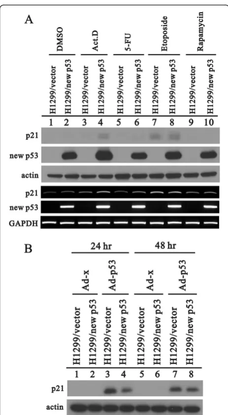 Figure 8 The new p53 variant, not wild-type p53, complexeswith the arginine methyltransferase CARM1 in HeLa cells.HeLa cells were transiently transfected with 0.5 μg of the indicatedpSG5.HA.p53 or new p53 variant along with 0.5 μg of pSG5.HA.CARM1