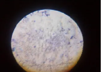 Fig �o. 1.Microbial population of soil grows on �utrient Agar Plate. 