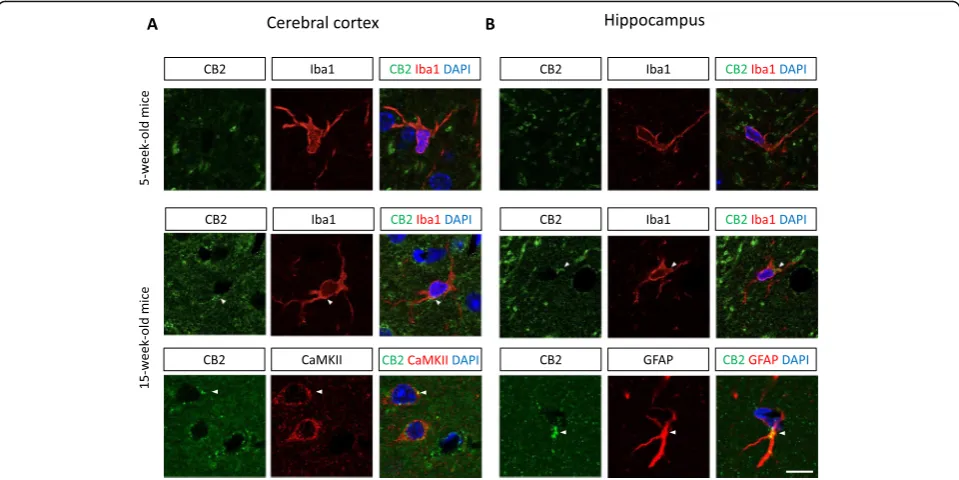 Fig. 3 Double immunostaining for CB2 (green) and Iba1, CaMKII, or GFAP (red) in the cortex (Note that the CB2 signal is greatly increased and localized to the microglia at 15 weeks of age