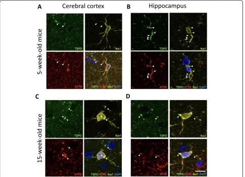 Fig. 4 Triple immunostaining for TSPO (green), ATPB (red), and Iba1 (yellow) in the cortex (a, c) and hippocampus (b, d) areas at 5 (a, b) and 15weeks of age (c, d)