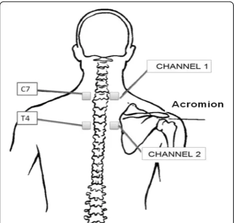 Fig. 2 Diagram showing the location for application of thetranscutaneous electrical nerve stimulation (TENS)