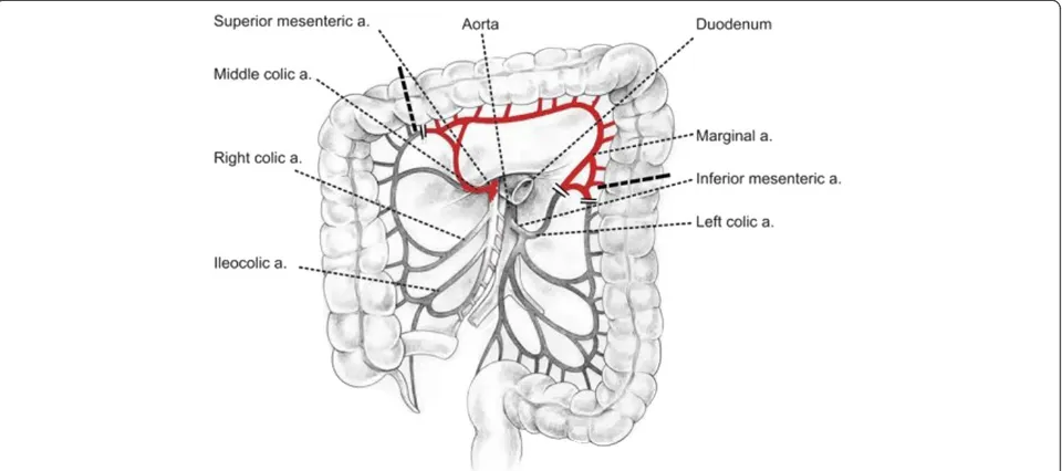 Table 1 Table summarizing published cases of metachronous neoplastic lesions in the gastric conduit