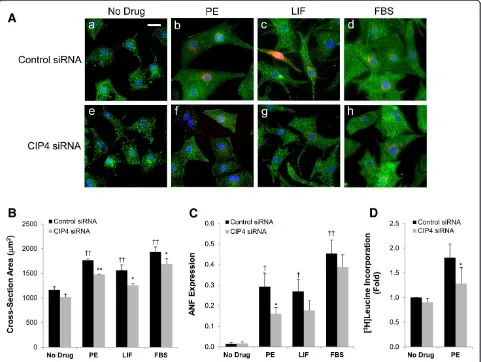 Figure 3 CIP4 is important for neonatal rat ventricular myocyte hypertrophy. Aexpressing ANF in A.