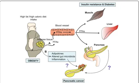 Fig. 1 A schematic representation of obesity- and diabetes-associated pancreatic cancer