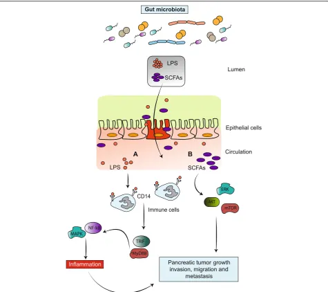 Fig. 3 Altered gut microbiota is responsible for pancreatic cancer progression.activate several inflammatory cytokines, leading to cancer cell proliferation.gut microbiota that enters the circulation