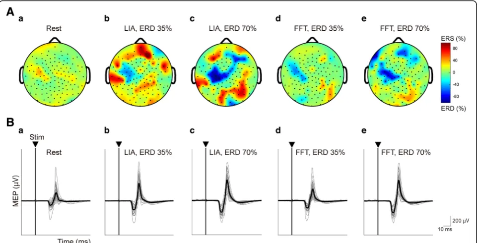 Fig. 3 Normalized peak-to-peak MEP amplitudes during motor imagery of right wrist extension at ERD 35% and ERD 70%, calculated by theincrease compared to those insignificantly associated with the different levels of motor imagery-related alpha ERDs
