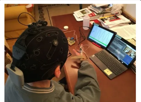 Fig. 1 Participant with right hemiparesis receiving transcranial directcurrent magnetic stimulation (tDCS) in their home simultaneouswhile performing the finger movement tracking task on the trackingcomputer (left)