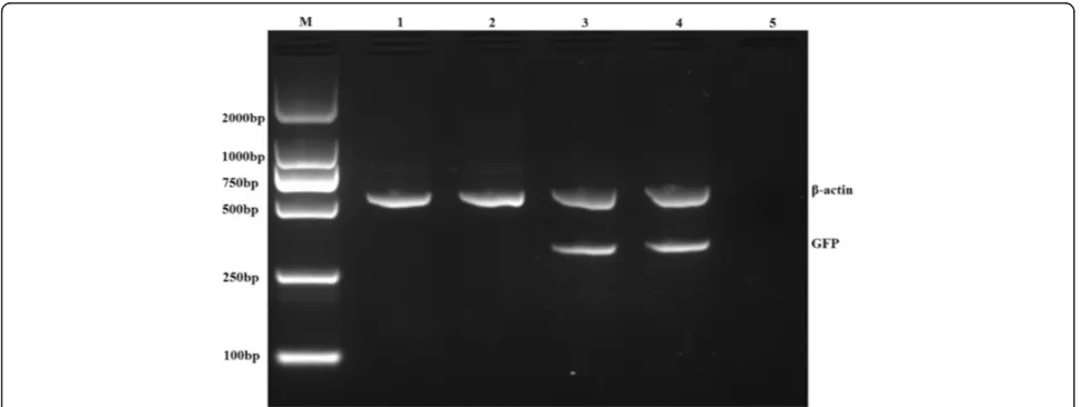 Figure 1 RT-PCR analysis of GFP mRNA transcripts in splenocytes of the rats from different groups