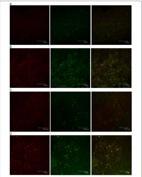 Figure 2 Immunofuorescent analysis of 4-1BBL expression on rat spleens. The expression of GFP and 4-1BBL in the spleens of differentgroups of rats was characterized by immunofuorescent assays using anti-4-1BBL (red) and anti-GFP (green) antibodies and exam