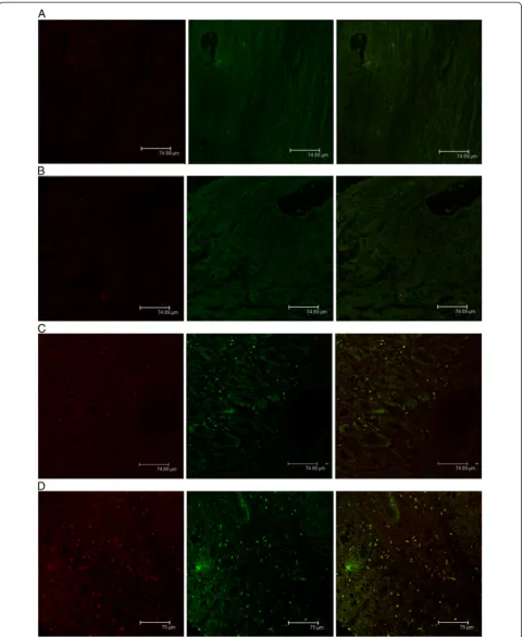 Figure 3 Immunofuorescent analysis of 4-1BBL expression on the colorectal tumor tissues of rats