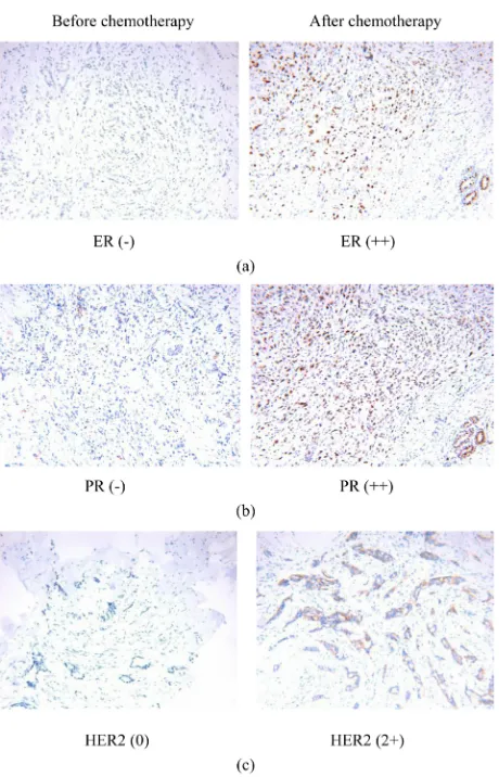 Table 4. The compare about ER, PR, HER2 change before and after neoadjuvant chemo-therapy