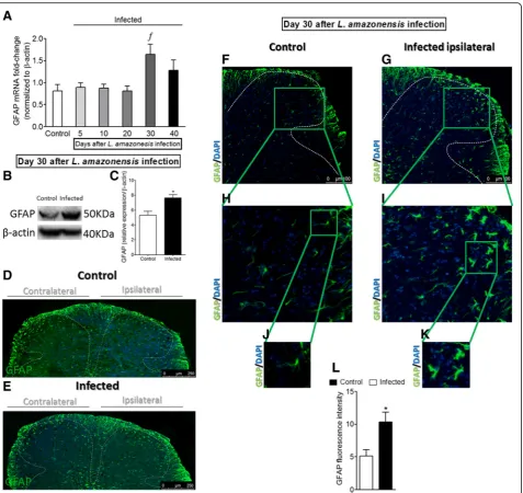 Fig. 3 Detection of spinal cord GFAP induced by i.pl. L. amazonensis infection. GFAP mRNA expression was determined in control non-infectedand infected mice after the infection (5–40 days) by RT-qPCR (a)
