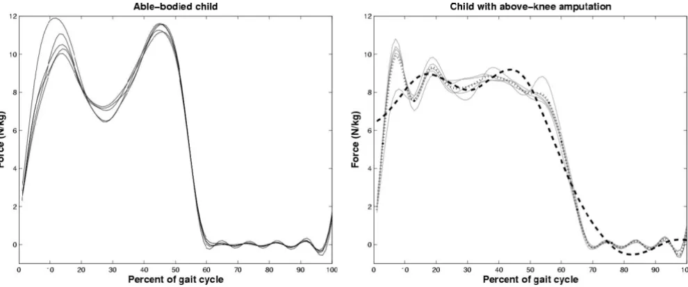 Figure 9Inconsistency in multiplicity and location of local extremafrom an able-bodied child (left) and from a child with above-knee prosthesis (right)
