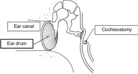 Figure 1 Diagram illustrating the anatomy of the ear and location of a cochleostomy.Note: Reproduced with the permission of John Wiley and Sons