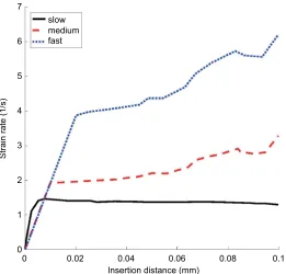 Figure 4 True strain for all simulations in the hyperelastic–viscoelastic three-dimensional finite-element model.Notes: Only certain combinations of needle parameters remained below the strain safety threshold for brain tissue