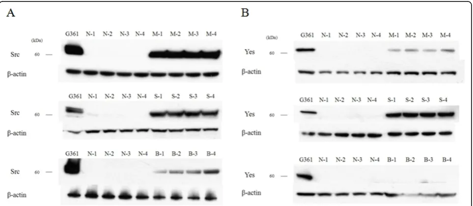 Figure 1 Western blot analysis for c-Src and c- Yes in malignant skin tumor and normal skin