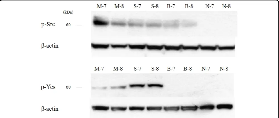 Figure 2 The score of expression amount using western blotting. (A) c-Src, (B) c-Yes.