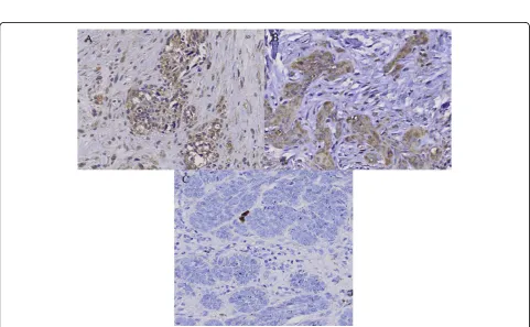 Figure 4 Immunohistochemical staining of c-Src in (A) malignant melanoma (MM), (B) squamous cell carcinoma (SCC) and (C) basalcell carcinoma (BCC)
