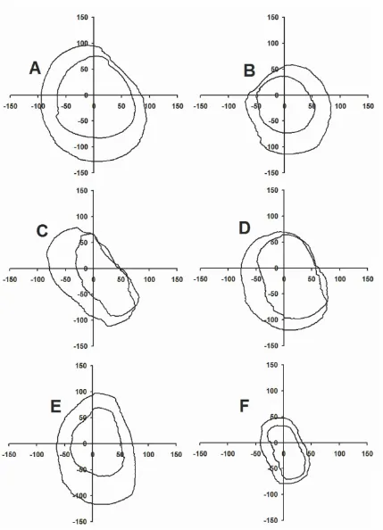 Figure 3Force envelopes before and after median nerve block of subjects A, B, C, D, E, and FForce envelopes before and after median nerve block of subjects A, B, C, D, E, and F